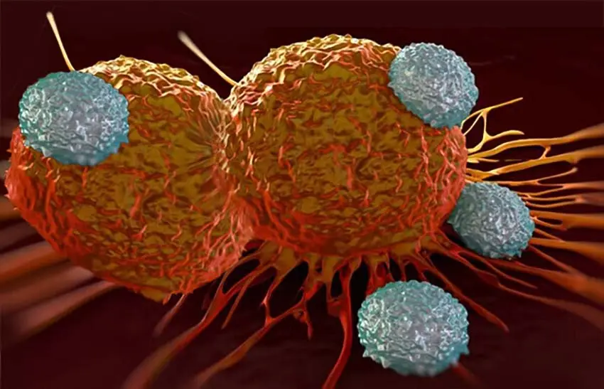 breast cancerسرطان سینه