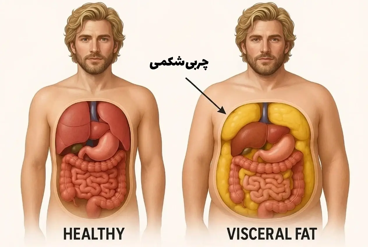 تصویر گرافیکی از محل قرارگیری چربی‌های خطرناک احشایی در میان اندام‌های داخلی بدن