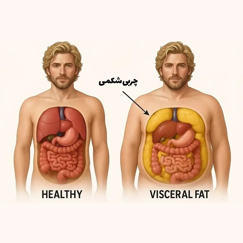 تصویر گرافیکی از محل قرارگیری چربی‌های خطرناک احشایی در میان اندام‌های داخلی بدن